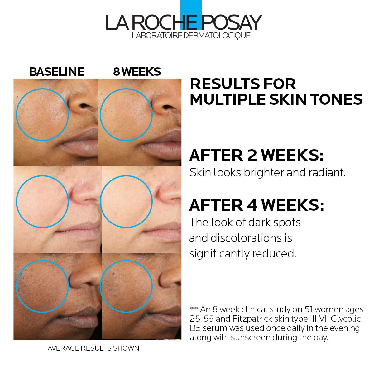 La roche-posay Glycolic B5 10% Pure Glycolic Acid Serum