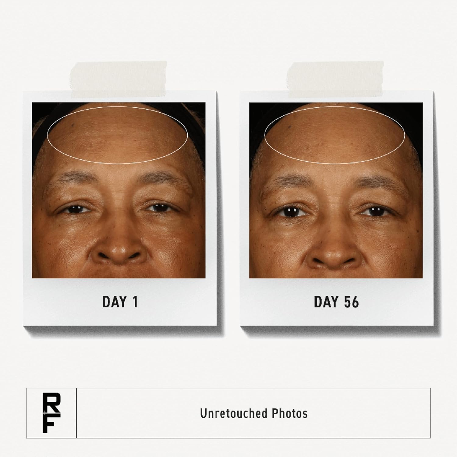 Rodan + Fields – Skintium
