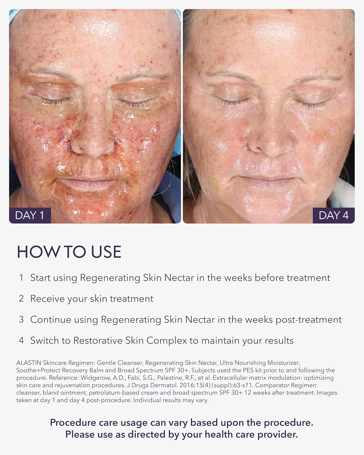 SkinCare Regenerating Skin Nectar Face Hydrating Moisturizer – 1 oz